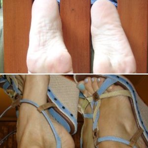 Personal foot Pics