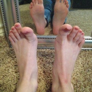 Flexed feet