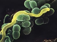 MM-301 (Dental Bacteria).JPG