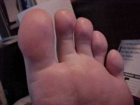 toes1.jpg