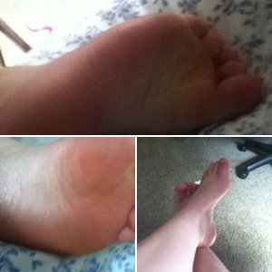 My ticklish feet