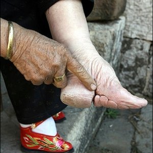 footbinding