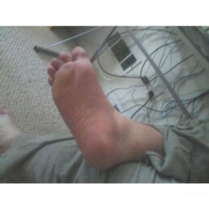 my right foot