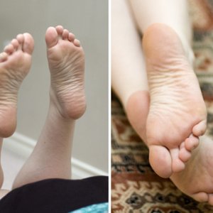 Wrinkly soles