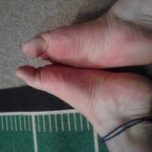 soles of feet