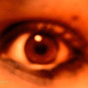 eye