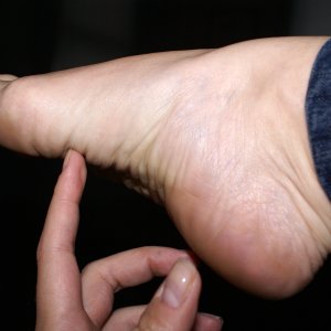 foot.pic