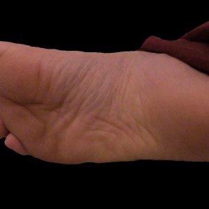 Sole of my right foot