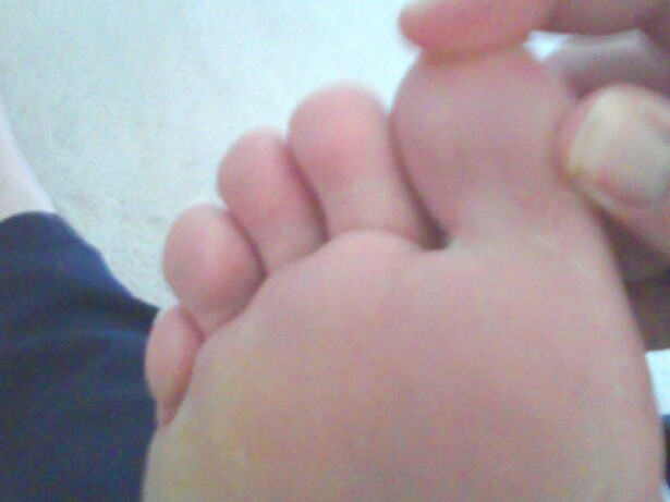 closeuptoes2