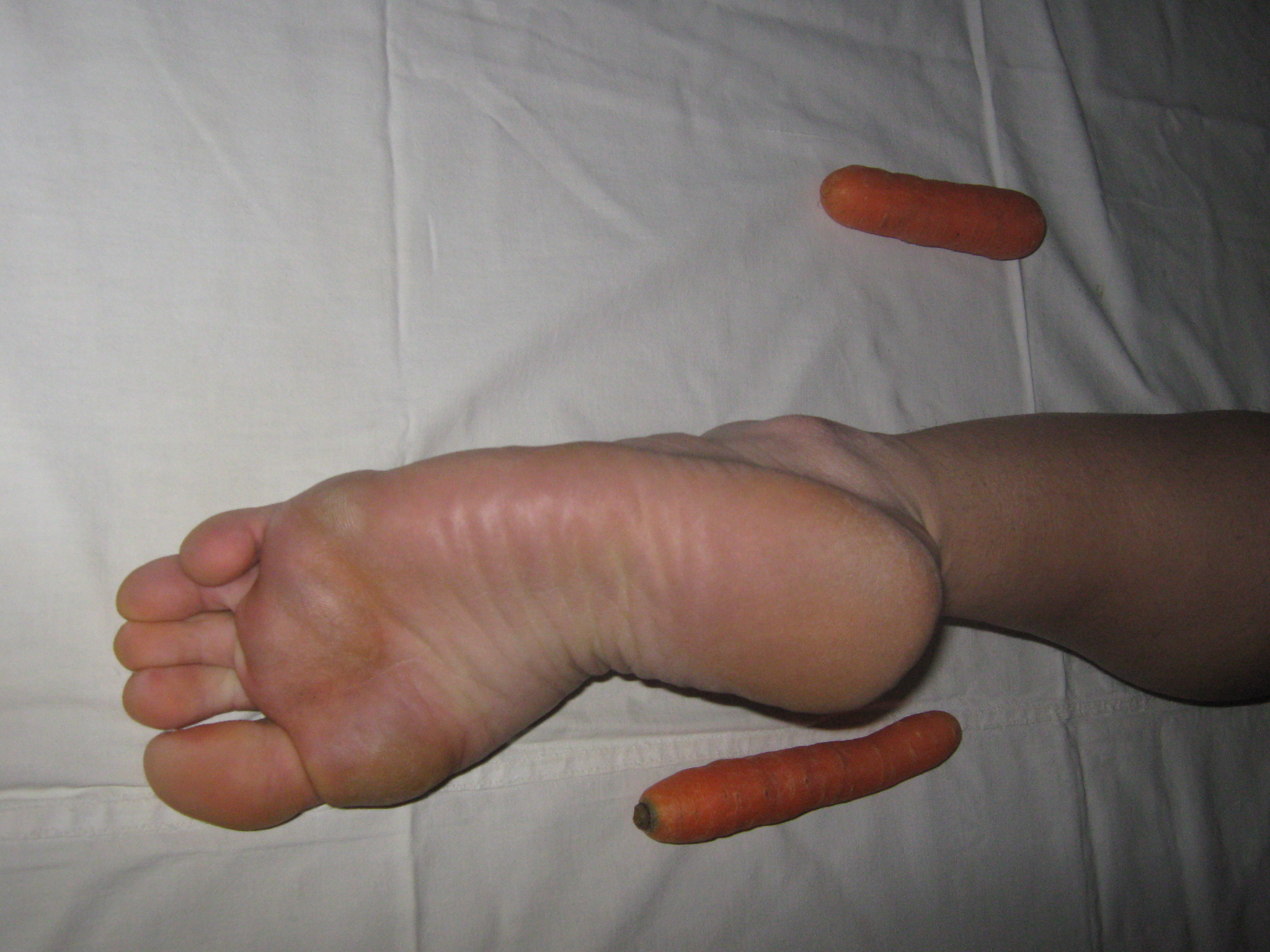 foot and carrots