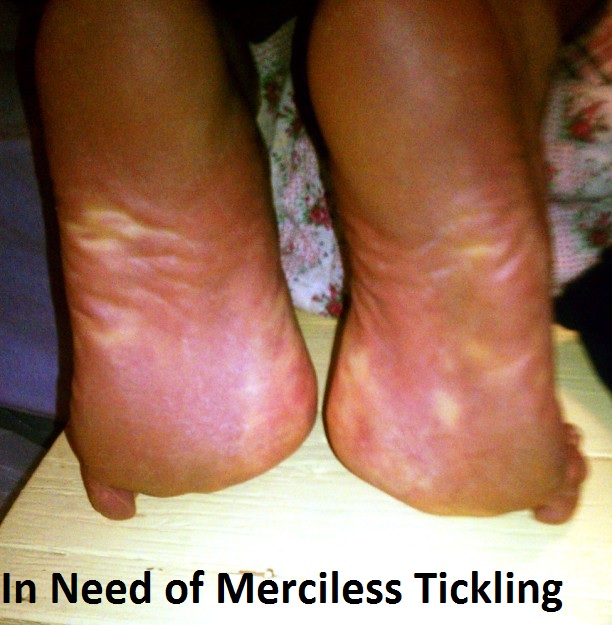 In Need of TIckling