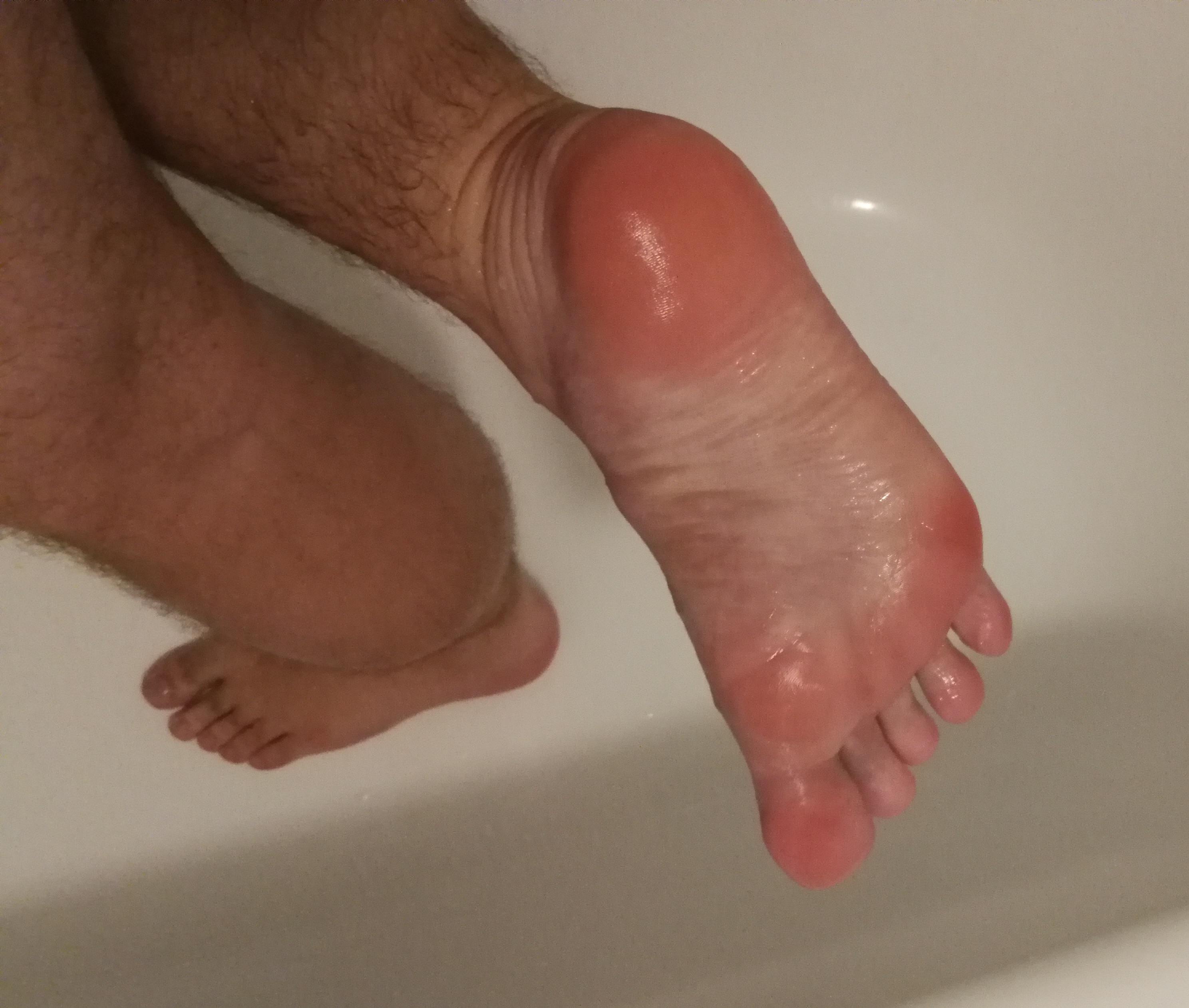 My feet 20