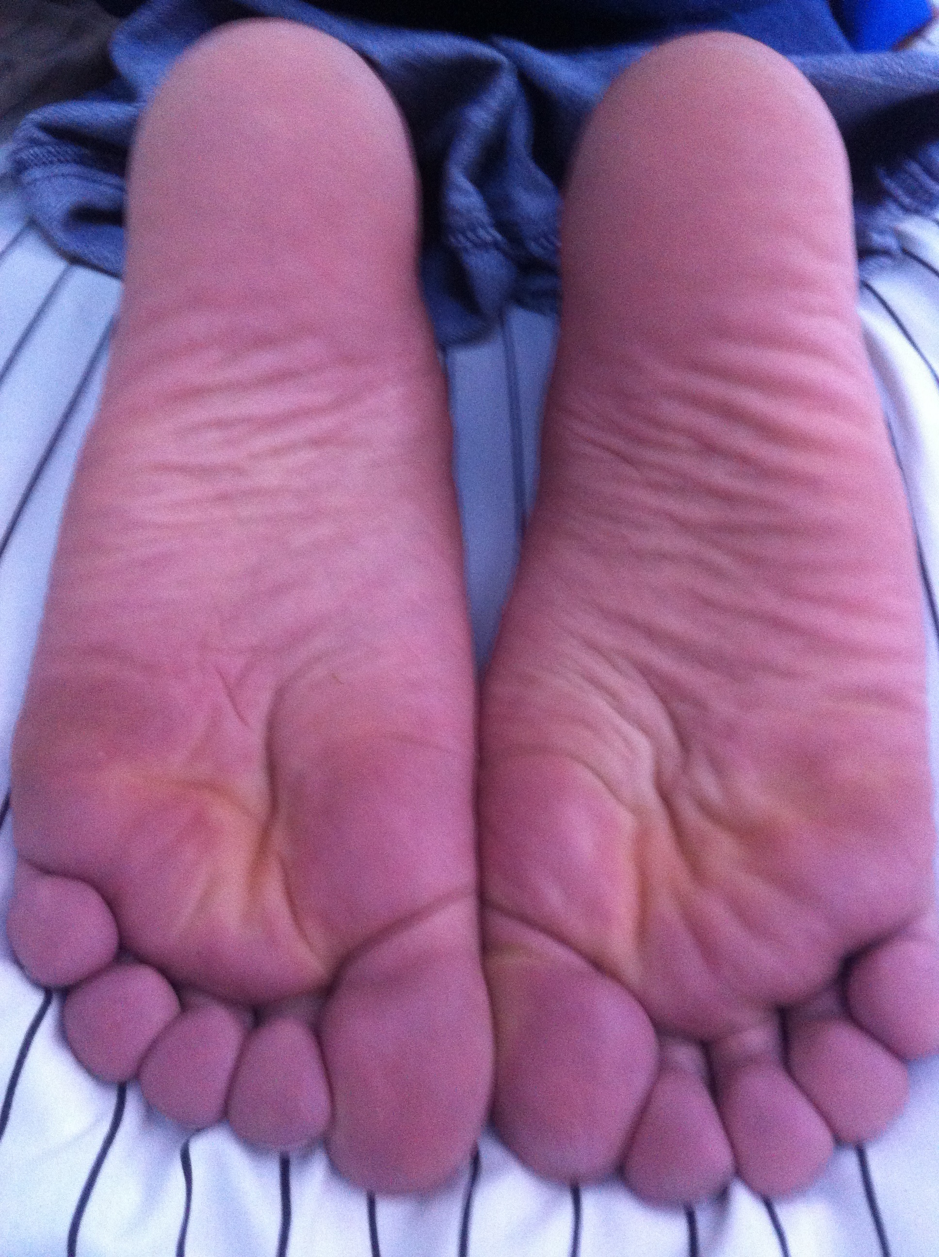 My feet after a fresh pedicure. 1/3