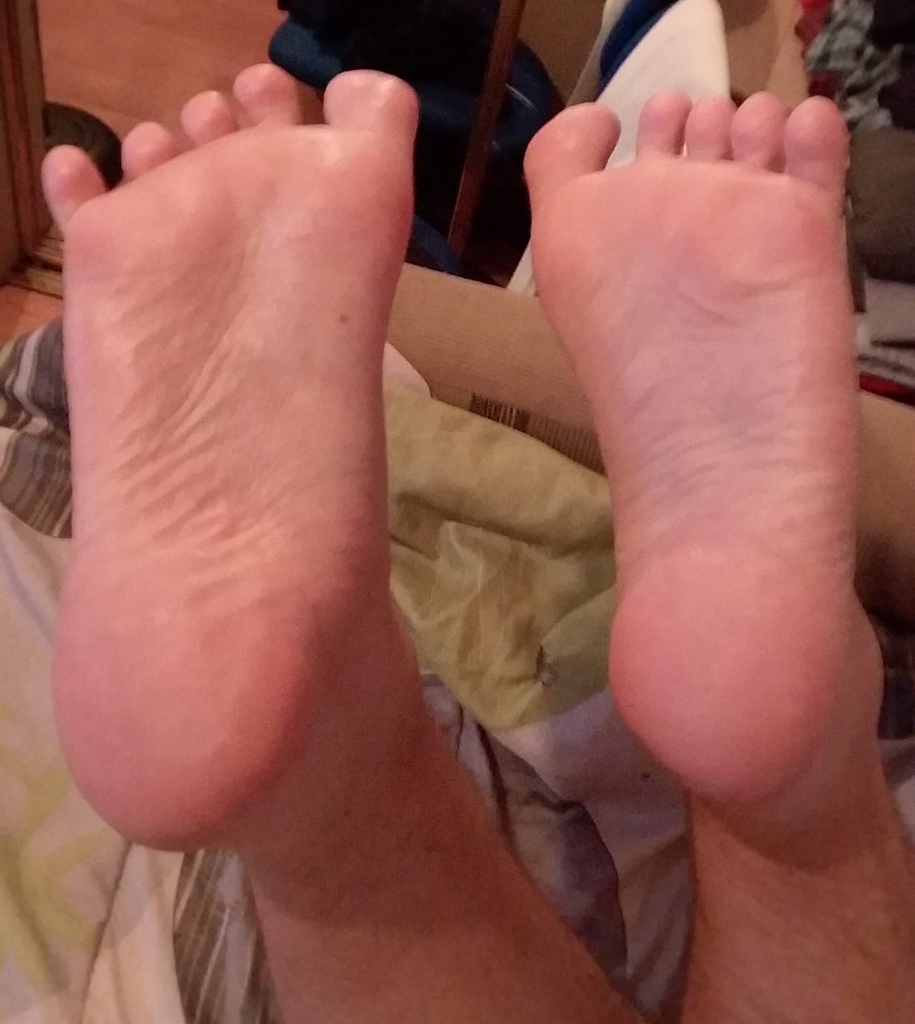 My soles here, after a decent amount of Coconut oil. I think it's amazing stuff! ^^