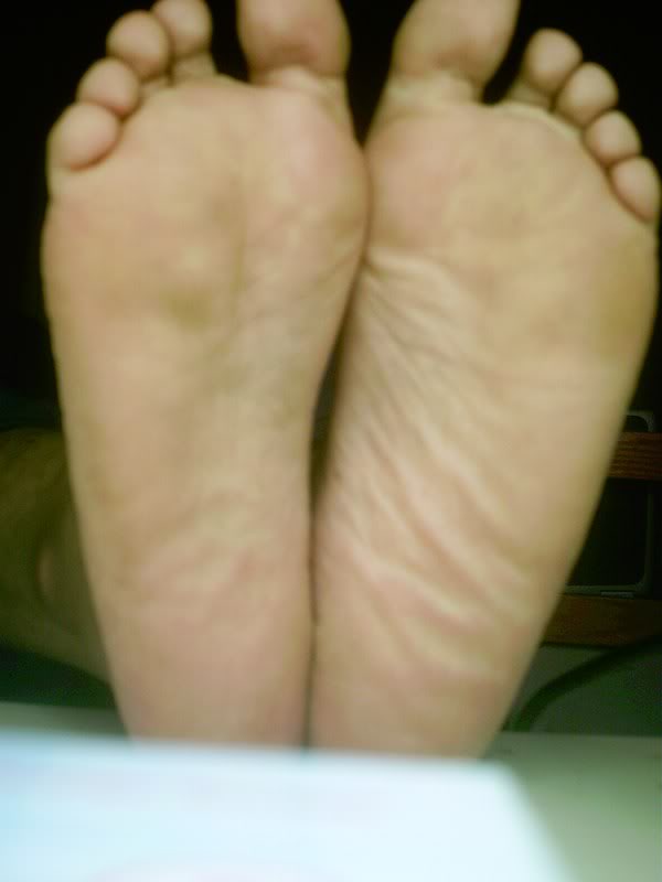 MyFeet4