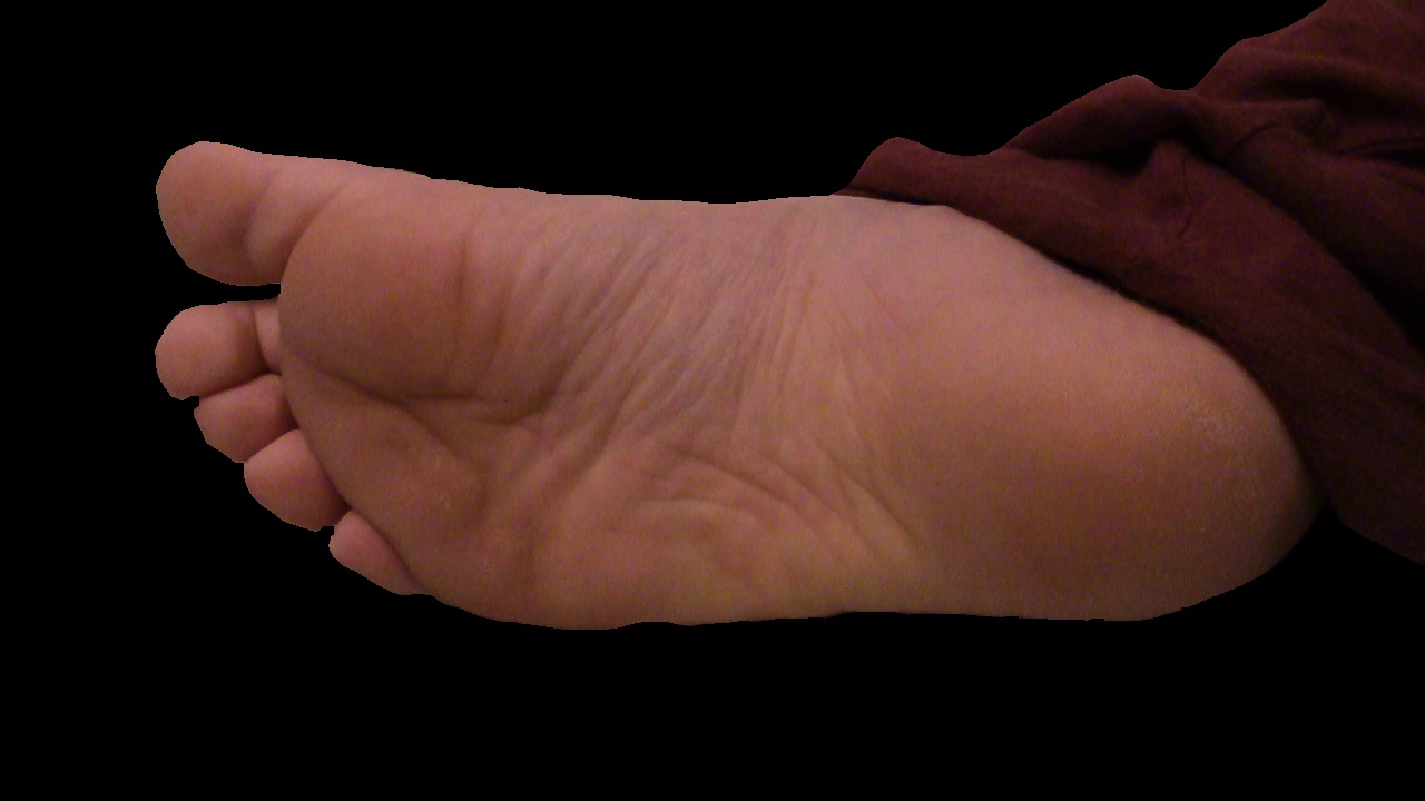 Sole of my right foot